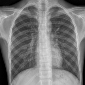 x-ray
