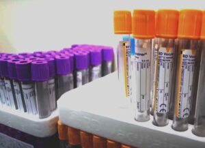 Read more about the article Monkeypox cases confirmed in 58 countries; Explore Now