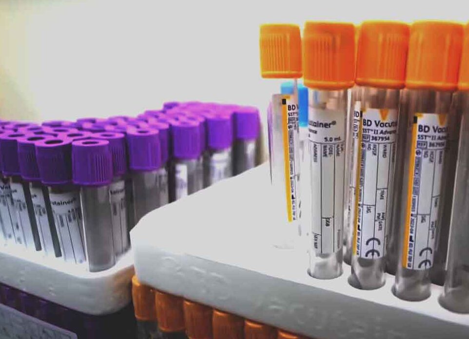 You are currently viewing Monkeypox cases confirmed in 58 countries; Explore Now