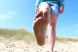 Read more about the article How to Stop Feet Swelling in Hot Weather Now