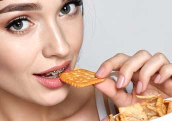 Read more about the article Snacks to Avoid With Braces | Smarter Snack Choices