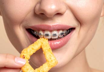 Braces-friendly diet tips: snacks to skip